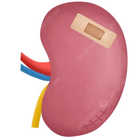 Medical Clip Art For Kidney Disease Chronic Kidney Disease Vector Art,