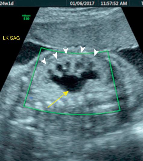 Fetal Urogenital Imaging - Clinical Tree