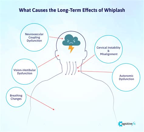 Whiplash Injury On Nerves