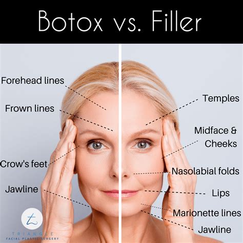Botox vs. Filler: What's the Difference? | Raleigh, NC | Triangle Facial Plastic Surgery