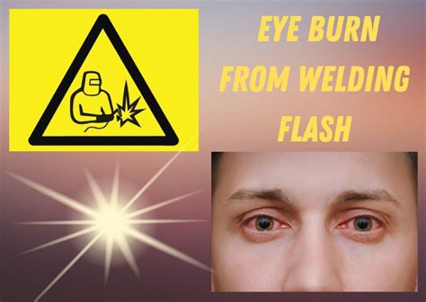 Image result for Weld Flash