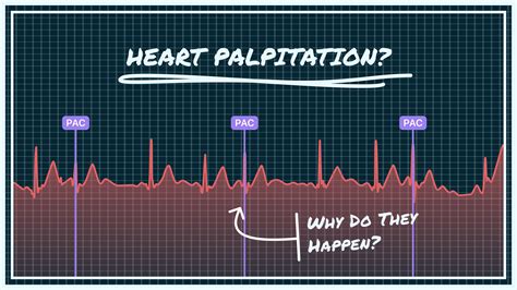 What Causes Heart Palpitations? Key Factors & Causes | Qaly
