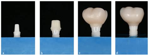 In Vitro Investigation of Material Combinations for Meso- and ...