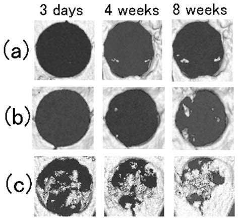 Bone Regeneration of Critical-Size Calvarial Defects in Rats Using ...