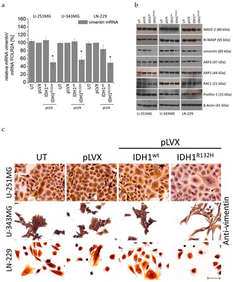 Radiosensitization and a Less Aggressive Phenotype of Human Malignant ...
