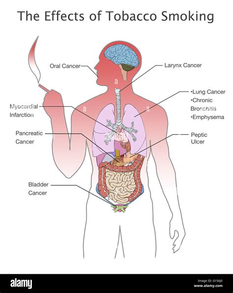 What Are The Adverse Effects Tobacco