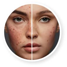 Roopayur Skin Healing Gel