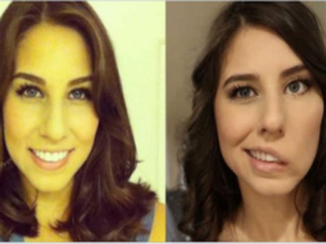 20-year-old beauty queen crippled after massive stroke - Times of India