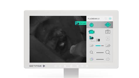 FLUOBEAM® LX - Advanced Autofluorescence Imaging for Parathyroid Glands ...