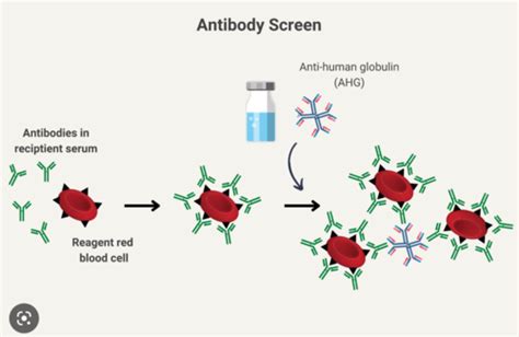 Image result for Dat vs Iat