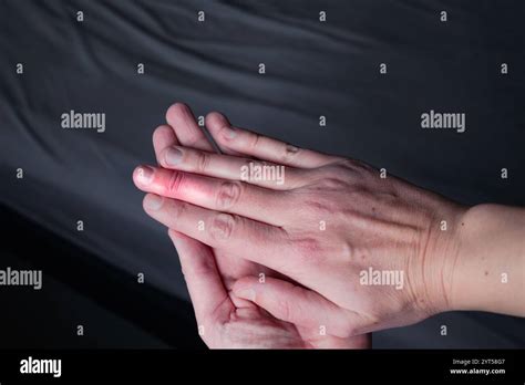 Splint Removal 的图像结果