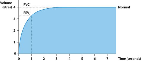 Spirometry Normal Values Chart 的图像结果
