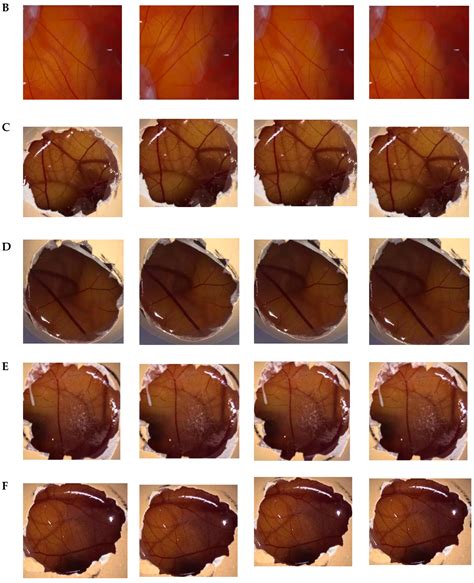 Development, Cytotoxicity and Eye Irritation Profile of a New Sunscreen ...