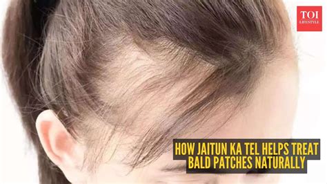 Olive oil for hair regrowth: How to use Jaitun ka Tel on bald patches ...