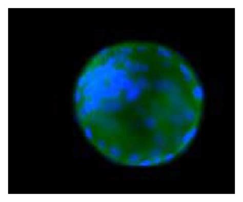 Image result for What Is LPAR