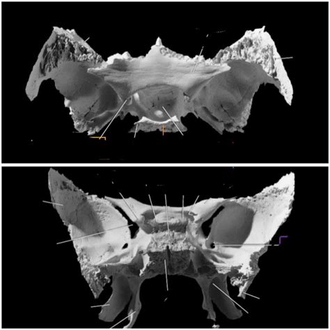 Rezultat imagine pentru Lymphatic System Fun