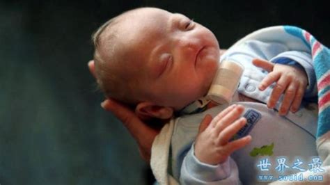 美国一婴儿天生没有鼻子，只能用嘴呼吸(图)-51区未解之谜网