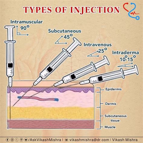Different Types of Injections
