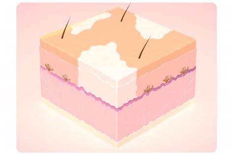 Fivfivgo™ White Spot Repair Cream – APWETY