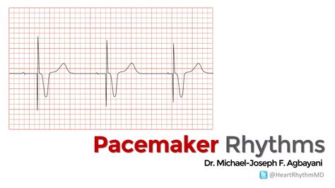 Pacemaker Rhythms | PDF