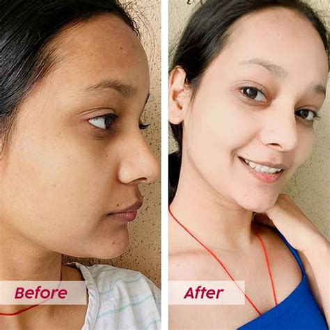 Buy Plix Glutathione Skin Glow 15 Effervescent Tablet 500mg for Clear ...