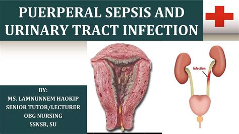 PUERPERAL SEPSIS & UTI.ppt