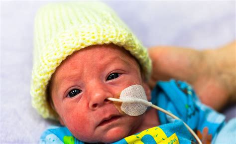 Infant Feeding for NICU Babies - Assential Therapies