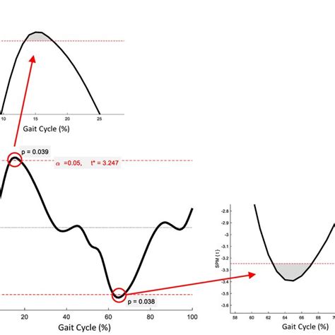 Statistical Parametric Mapping 的图像结果