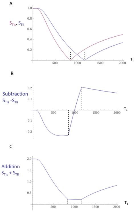 Diagnosis of Delayed Post-Hypoxic Leukoencephalopathy (Grinker’s ...