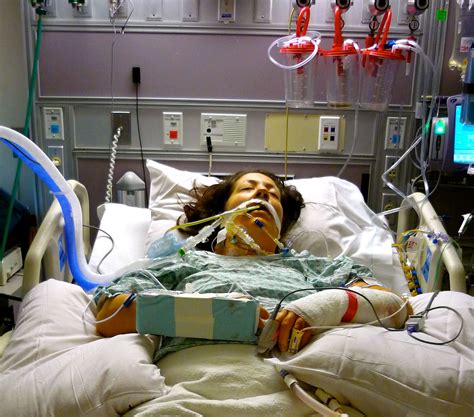 Dental Treatment After Open Heart Surgery at Lisa Post blog