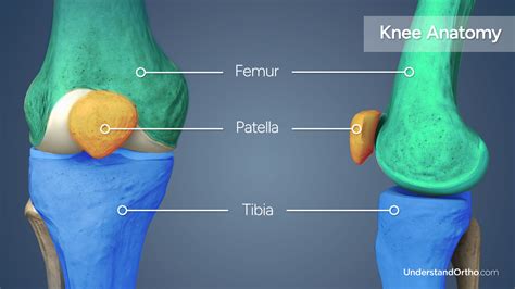 Patella Realignment – UnderstandOrtho™