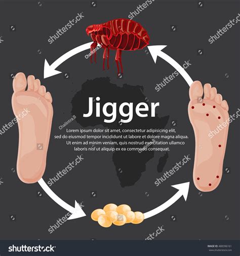 Jigger Fleas Remove 的图像结果