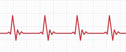 Basic ECG Training - Academy of Global Education (AGE) - Healthcare ...