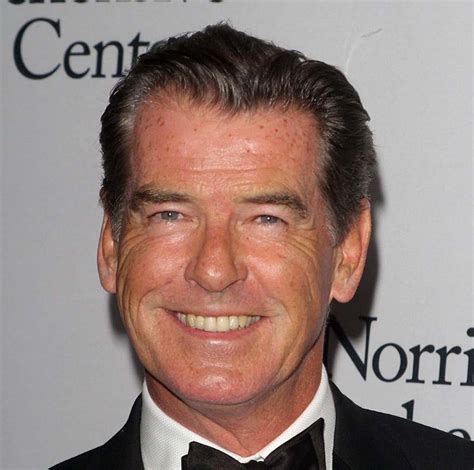 Celebrities with Bell's Palsy