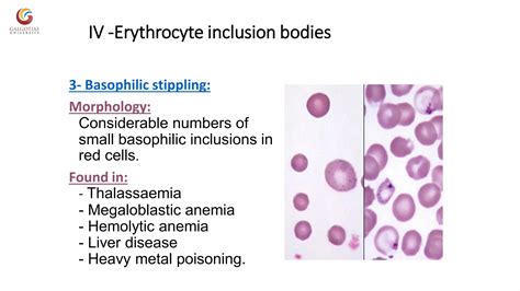 Abnormal morphology of rbc notes | PDF