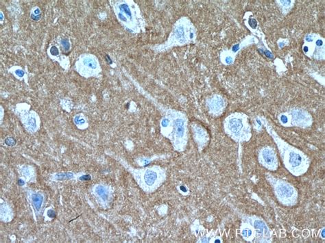 RHOB antibody (14326-1-AP) | Proteintech
