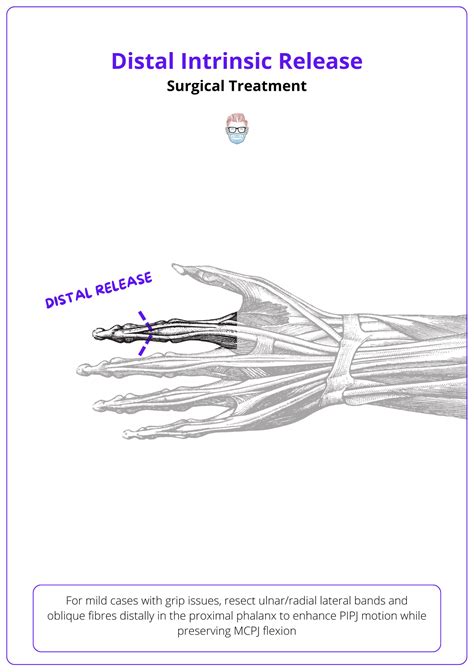 Intrinsic "Plus" Hand: Anatomy, Aetiology, and Management