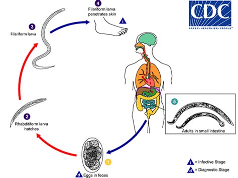 Hookworm infection, symptoms, diagnosis & hookworm treatment in humans