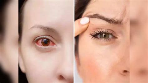 Eye Twitching Causes,Eye Twitching : வலது கண், இடது கண் எது ...