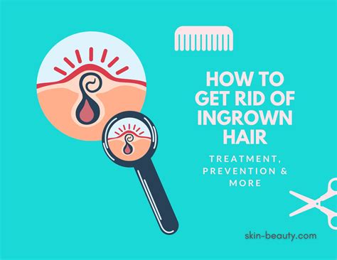 How to Get Rid of Ingrown Hair - Skin Beauty