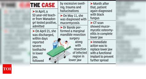 Reconstruction surgery gives new jaw to 52-yr-old double mucor-hit ...