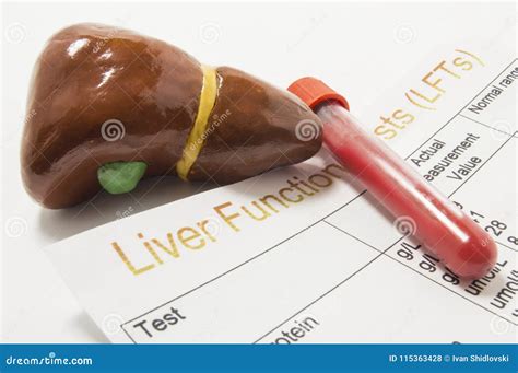 Image result for Liver Enzyme Lab Test