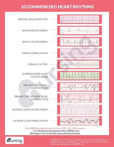 Cs-cardiac-002-10 common ekg heart rhythms - NURSING - "Tools and Confidence to Succeed in - Studocu