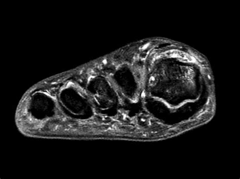 Foot and Ankle imaging | Philips MR Body Map