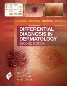 Differential Diagnosis in Dermatology: Buy Differential Diagnosis in ...