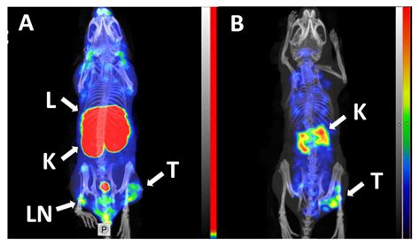 Radionuclide Molecular Imaging of EpCAM Expression in Triple-Negative ...
