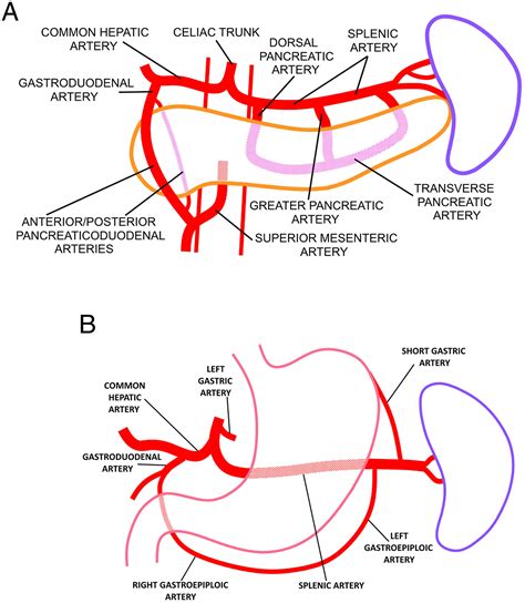 Splenic Artery Aneurysm Symptoms Mayo – KXVG