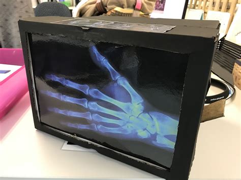 diy xray