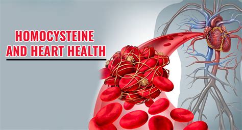 HOMOCYSTEINE AND HEART HEALTH