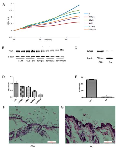 Desmoglein1 Deficiency Is a Potential Cause of Cutaneous Eruptions ...